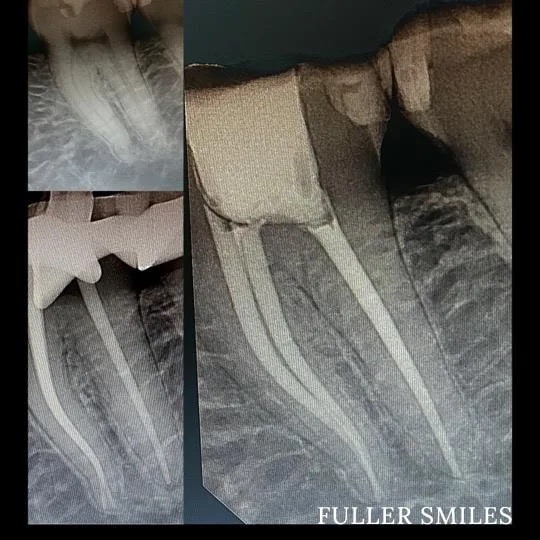  html    head  title 500 Internal Server Error  title   head    body    center  h1 500 Internal Server Error  h1   center    hr  center nginx 1.29.3  center     body     html 