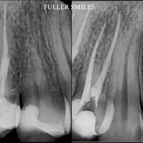  html    head  title 500 Internal Server Error  title   head    body    center  h1 500 Internal Server Error  h1   center    hr  center nginx 1.29.3  center     body     html 