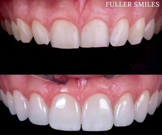  html    head  title 500 Internal Server Error  title   head    body    center  h1 500 Internal Server Error  h1   center    hr  center nginx 1.29.3  center     body     html 